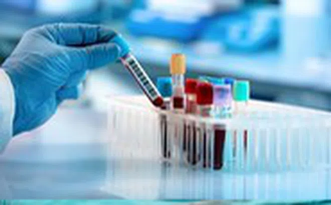 7 xét nghiệm máu không cần nhịn ăn