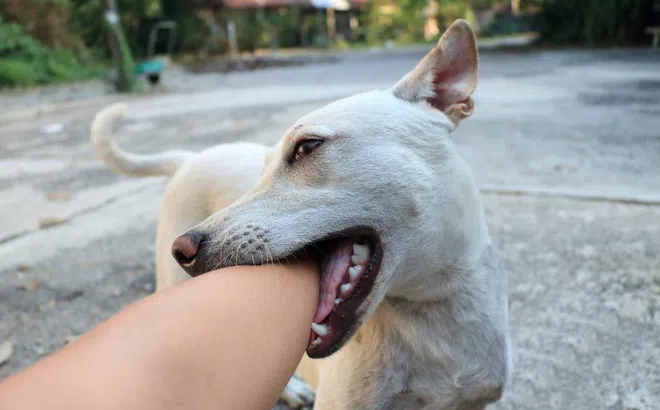 Trẻ bị chó cắn vào má ở Sơn La đã không qua khỏi