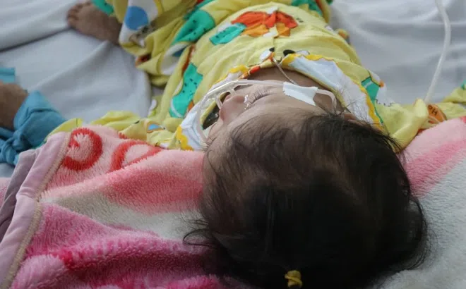 Đã có hơn 500 ca mắc, TP.HCM đủ điều kiện công bố dịch sởi?