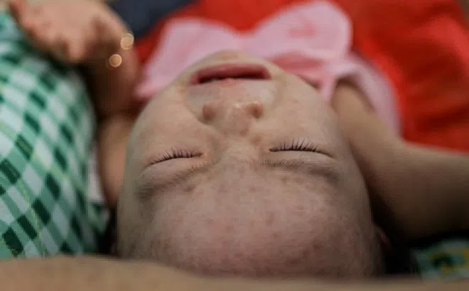TP.HCM tiêm vaccine sởi cho tất cả trẻ em từ 31/8