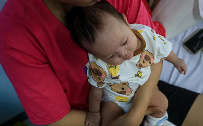 Số ca bệnh sởi tại TP.HCM lập đỉnh mới