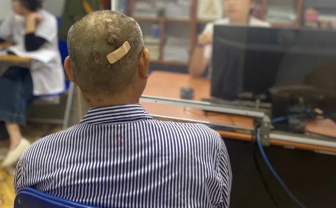 Biến chứng nặng vì tự ý dừng thuốc chữa tiểu đường, nhịn ăn gián đoạn