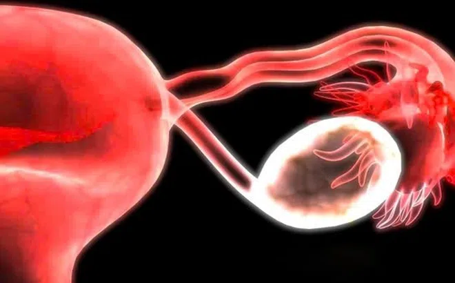 Phát hiện mới mở ra bí ẩn của thời kỳ mãn kinh