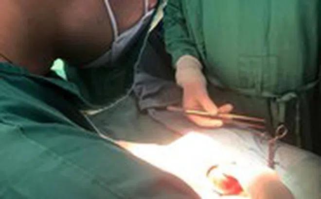 Chậm đi viện, 2 nam sinh cùng mất một bên tinh hoàn do xoắn tinh hoàn hoại tử