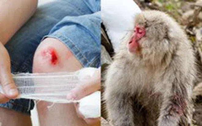 Tại sao vết thương của con người lại lâu lành hơn động vật?