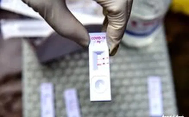 Có triệu chứng nghi ngờ mắc COVID-19, cần test nhanh không?