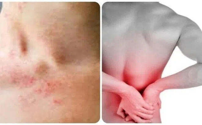 Những triệu chứng suy thận nhẹ bạn cần biết