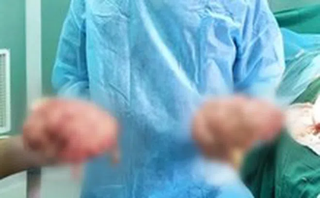 Nữ bệnh nhân mắc bệnh hiếm, hai vùng đùi bên ngoài như hai quả bóng