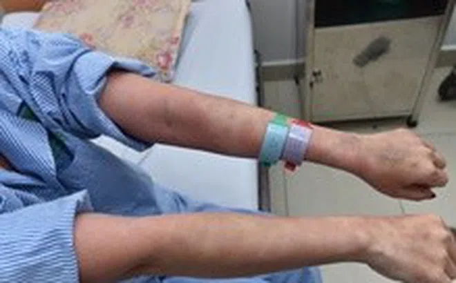 Nguy kịch sau khi dùng thuốc giảm mỡ bụng và collagen không rõ nguồn gốc