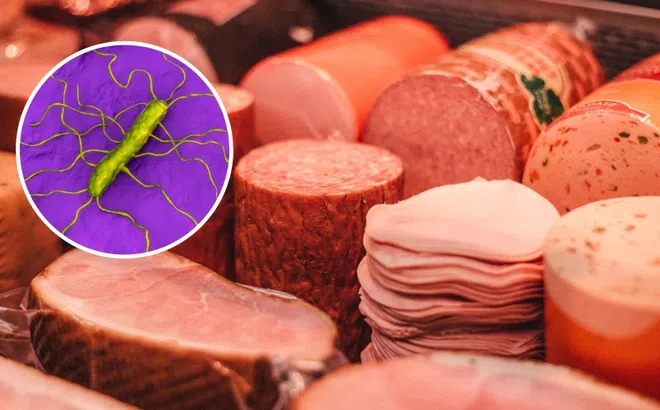Loại vi khuẩn dễ nhiễm khi ăn thịt nguội, sữa chưa tiệt trùng