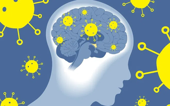 Nghiên cứu mới: Đại dịch Covid-19 làm tăng tốc độ lão hóa của não