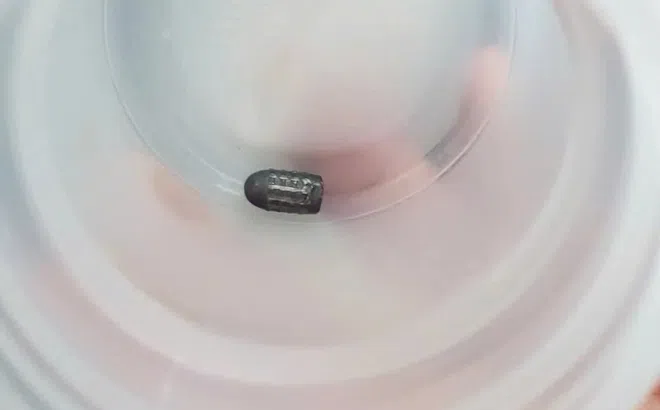 Người phụ nữ bị vật lạ găm vào đầu, nghi đạn lạc