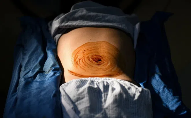 Phớt lờ những cơn đau âm ỉ, người Việt trẻ phải lên bàn mổ