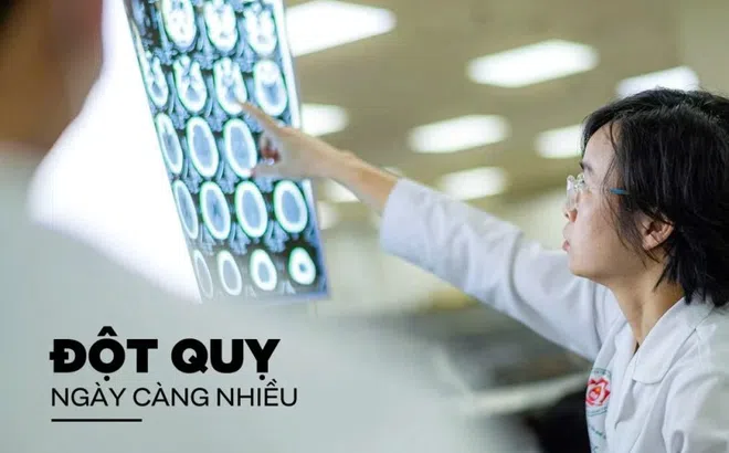 Vì sao đột quỵ ngày càng nhiều?