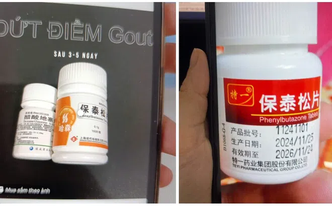 Dùng thuốc trị gout Phenylbutazone đã bị cấm, nhiều người nhập viện