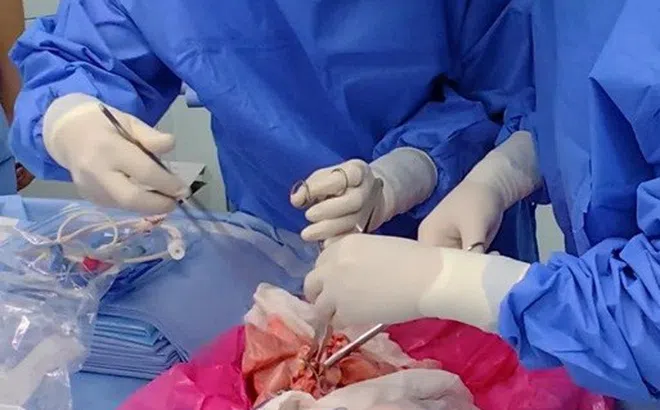 Lần đầu ghép thành công phổi heo cho người chết não