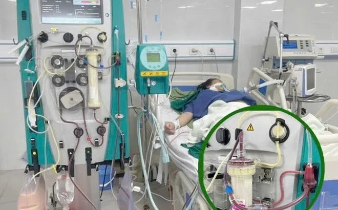 Người phụ nữ 35 tuổi phải lọc máu cấp cứu ngay sau khi sinh con