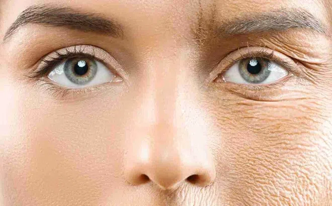 Serum tự làm từ phèn chua và vitamin E giúp xóa nếp nhăn vĩnh viễn?