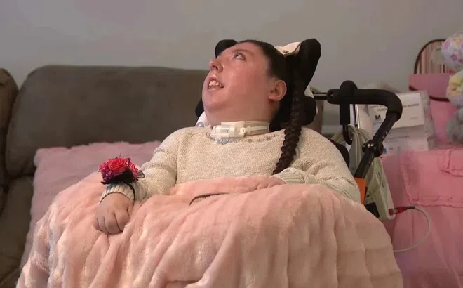 Cuộc sống hiện tại của cô gái không có não