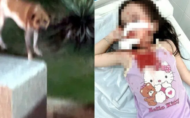 TP.HCM: Bé gái bị chó tấn công, thương tích nghiêm trọng vùng mặt