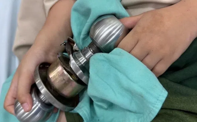 Bác sĩ TP.HCM thành 'thợ sửa ổ khóa' ngay trong phòng mổ