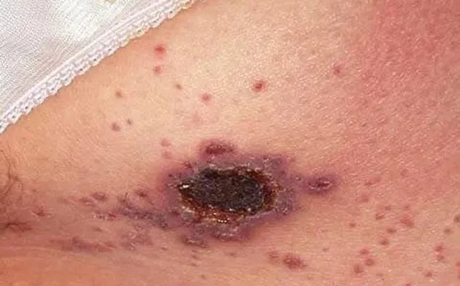 Những ca phát hiện HIV khiến bác sĩ 'giật mình'