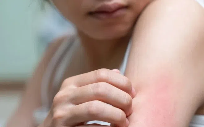 Dấu hiệu hệ tiêu hóa quá tải, cần thay đổi càng sớm càng tốt