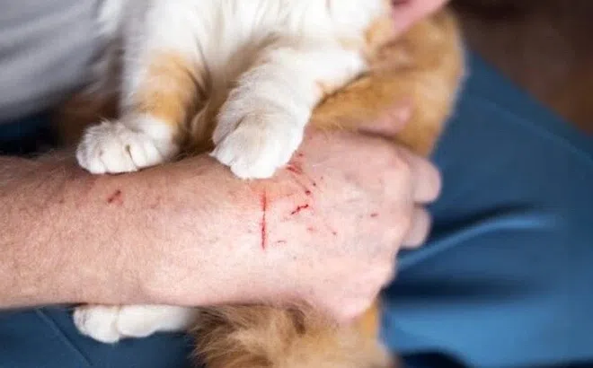 Bị mèo cào, người đàn ông ở TP.HCM tử vong thương tâm