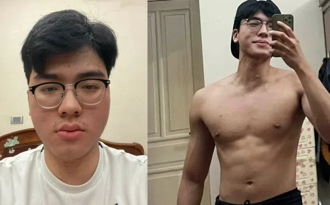 Diện mạo khác lạ của nam người mẫu sau 2 năm mắc bệnh thận